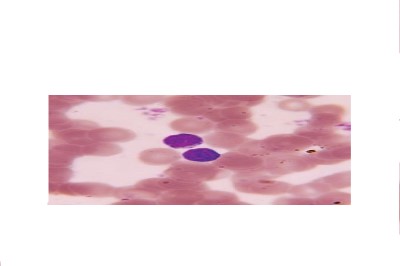 May Grunwald Solución